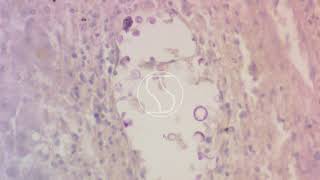 Cryptococcus neoformans under the microscope with Periodic acidSchiff PAS stain [upl. by Rissa]