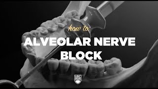 How To  Alveolar Nerve Block ubcmedicine ubcdentistry [upl. by Artenehs100]