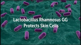 Lactobacillus Rhamnosus GG Protects Skin Cells  Probiotic Skin Acne Psoriasis Eczema [upl. by Lindly]