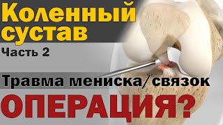 Делать ли пластику связок  мениска коленного сустава S05E13 [upl. by Fineberg]