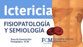 Ictericia  Fisiopatología y Semiología [upl. by Tekcirc]