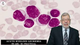 Acute Myeloid Leukemia 04 M1 Practical [upl. by Selrhc]