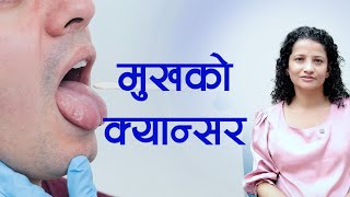 मुखमा घाउ छ कस्तो बेला क्यान्सरको जाँच गर्नु पर्छ Dr Kamana Chalise  NIKO NEPAL [upl. by Orimlede313]