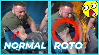 ❌ RUPTURA de BICEPS causas y como evitarla ROTURA TENDÓN DEL BICEPS 😲LOS BICEPS QUE LLORAN [upl. by Repsac]