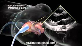 How to do a Basic Transthoracic Echocardiogram Transducer Position and Anatomy [upl. by Son]