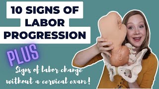 10 Signs of Labor Progression  Its WAY more than Dilation [upl. by Kroo]