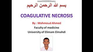 المحاضرة السادسة  شرح ال Coagulative necrosis  طبيبسودانيTSD [upl. by Haon]