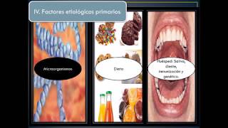 Caries dental concepto y etiología [upl. by Eleynad]