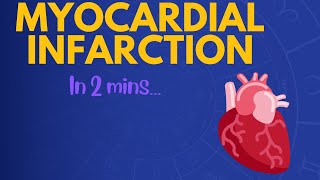 Myocardial Infarction in 2 mins [upl. by Ailero]