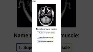 👁️ Anatomy Quiz Extraocular muscle [upl. by Victor]