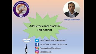 Adductor canal block for TKR [upl. by Shirberg]