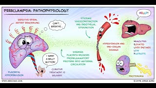 How to Fix a quotLeaky Faucetquot Brain [upl. by Adnohsek]