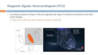 Short Topics in ECG Vectorcardiogram VCG Arabic Narration [upl. by Noryb]