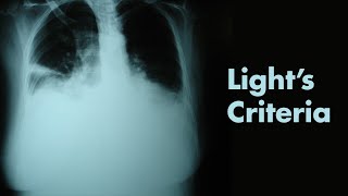 Lights Criteria amp Pleural Effusions  MEDZCOOL [upl. by Huey]