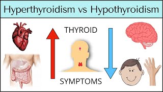 Hyperthyroidism vs Hypothyroidism Symptoms MADE EASY Thyroid Explained [upl. by Ennirac]