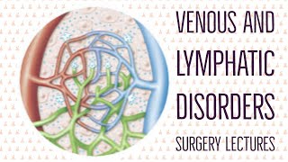 LYMPHATIC DISORDERS lecture 1 LYMPHEDEMA most important points in a single video [upl. by Wagshul103]