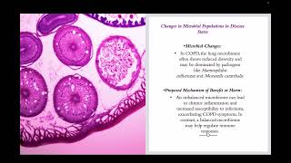 COPD Microbiome [upl. by Mendez314]