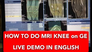 Knee Joint MRI scan protocol positioning and planning on GE 15 Tesla  Live Demo in English [upl. by Ardnasal]