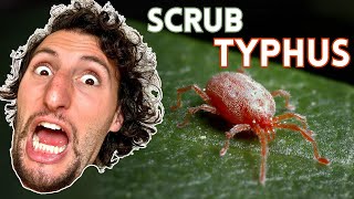 Scrub Typhus Diagnosis amp Management [upl. by Cordi]