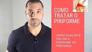 Como tratar a síndrome do piriforme [upl. by Aletse]