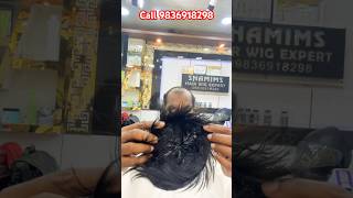 hair wigs for men in Kolkatahair wigs for women Kolkatahair extensions in Kolkatafronthairline [upl. by Akiaki162]