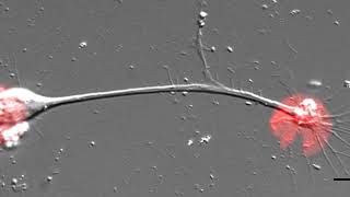 Cytoskeletal Mechanisms of Axonal Contractility [upl. by Neal]