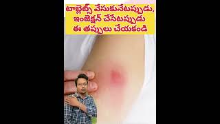 టాబ్లెట్స్ ఇలాగే వేసుకోవాలని తెలియక తప్పు చేశా healthtips doctor medicalprofession paramparik [upl. by Zelazny]