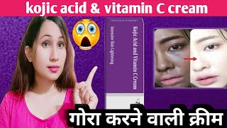 Kojic acid and vitamin C cream honest Review kojic acid and vitamin c cream  2024 [upl. by Aloibaf]