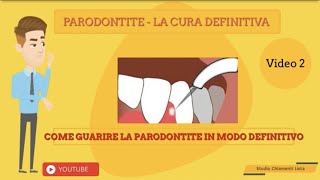 Parodontite cura [upl. by Demahom708]