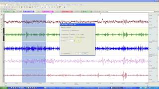 Fast Fourier Transformation [upl. by Belle]