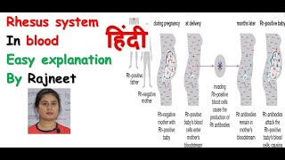 Rhesus system in hindi  Rh incompatibility  haemolytic disease  Rj medical education [upl. by Dorison]