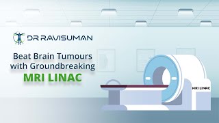 Introducing the Latest Technology for Treating Brain Tumor The MRI LINAC [upl. by Eaves]