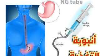 شرح محاضرة nasogastric tube insertion تركيب أنبوبة الأنف المعدية أفضل شرح ممكن تسمعه في حياتك NGT🥱💯🔥 [upl. by Alduino]