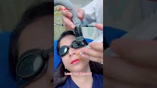 Laser Hair Removal getsmarthairclub viralvideo viralshort [upl. by Ayikur165]