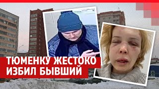 Тюменку полгода преследовал бывший возлюбленный а потом избил до полусмерти [upl. by Claiborne]