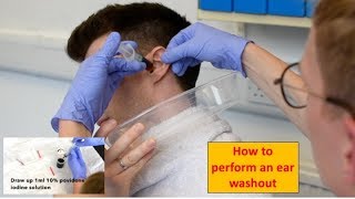 How to Perform an Ear Washout irrigation  ENTOtolaryngology Skills [upl. by Eenor945]