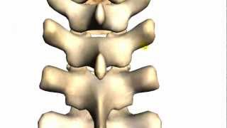 Spine tutorial 2  Features of a vertebra  Anatomy Tutorial [upl. by Atnoed]