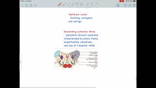 Lateral Medullary Syndrome Wallenburg syndrome PICA syndrome [upl. by Gower550]