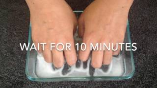 How to whiten your nails naturally [upl. by Ramraj]