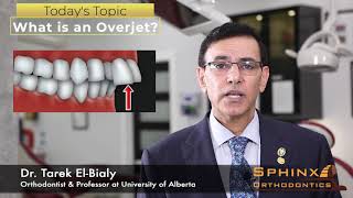 8 What is an Overjet Sphinx Orthodontics Edmonton Invisalign amp Orthodontics [upl. by Ueik]