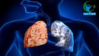 क्या है COPD बीमारी और इसका इलाज  देखें video में  What is COPD And Its Remedies [upl. by Refinneg243]