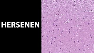 Hersenen histologiemicroscopie van de hersenen [upl. by Pinzler]