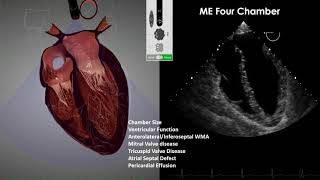 Transesophageal Echocardiography TEE Imaging [upl. by Sommer]