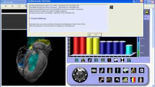 Electro Interstitial Scan Prioritization [upl. by Yeliah868]