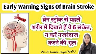 Early warning signs of Brain Stroke Paralysis  ब्रेन स्ट्रोक होने से पहले के 6 जरूरी संकेत [upl. by Reviel]