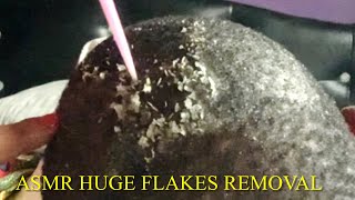 Asmr Scratching Tough Flakes  Huge Flakes Removal With Rain Sounds For Deep Sleep [upl. by Griggs]