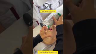 Tracheal Intubation Technique  Intubation procedure shorts [upl. by Eyk272]