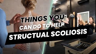 Things you CAN do to help your structural Scoliosis [upl. by Alyahsal]