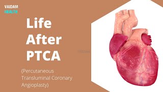 Life After PTCA Percutaneous Transluminal Coronary Angioplasty [upl. by Gabriel]