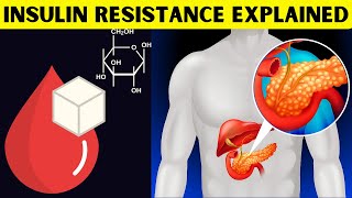 Insulin Resistance Explained What Is Insulin Resistance amp How It Leads To Type II Diabetes [upl. by Jelene34]